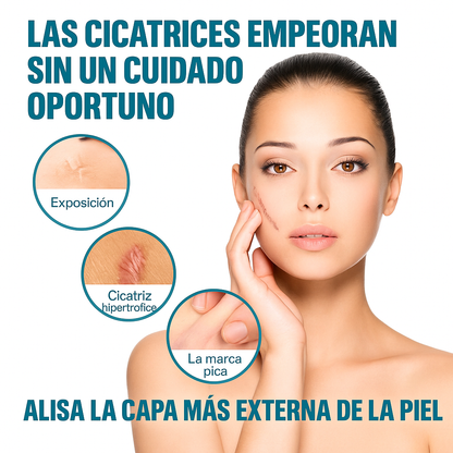 ✅ Tratamiento de Cicatrices Usado por Dermatólogos – Ahora en Casa