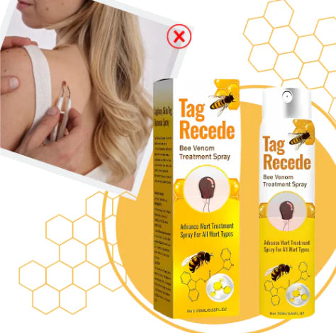 Eliminador de Verrugas Natural – Tag Recede™ El Original